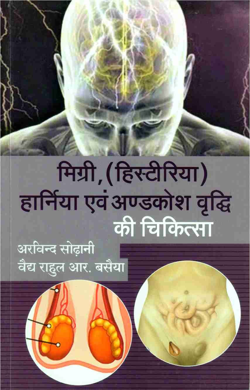 Mirgi (Histiria) Harnia, Chikitsa